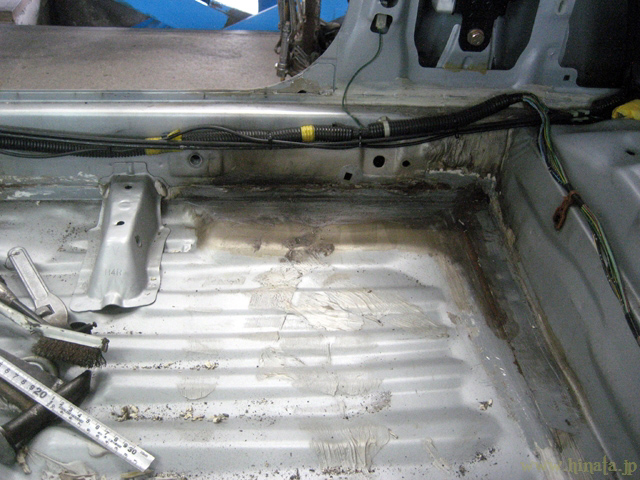 切除範囲を決める